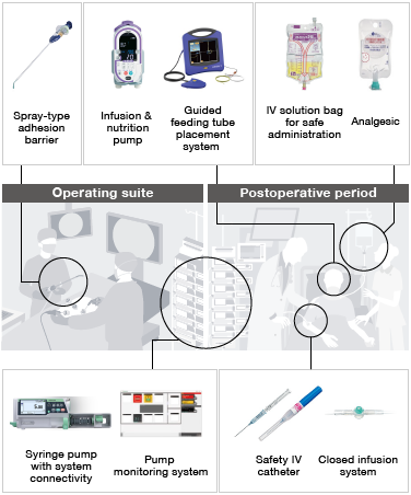 Spray-type adhesion barrier / Infusion & nutrition pump / Guided feeding tube placement system / IV solution bag for safe administration / Analgesic / Operating suite / Postoperative period / Syringe pump with system connectivity / Pump monitoring system / Safety IV catheter / Closed infusion system