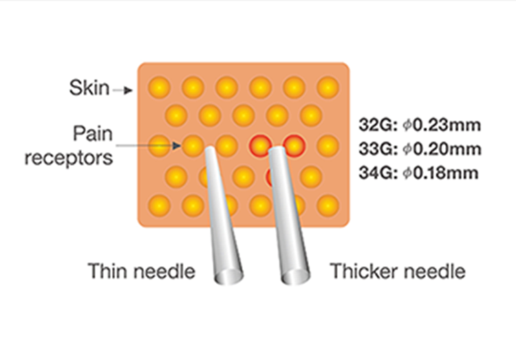 Skin/Pain receptors/Thin needle/Thicker needle