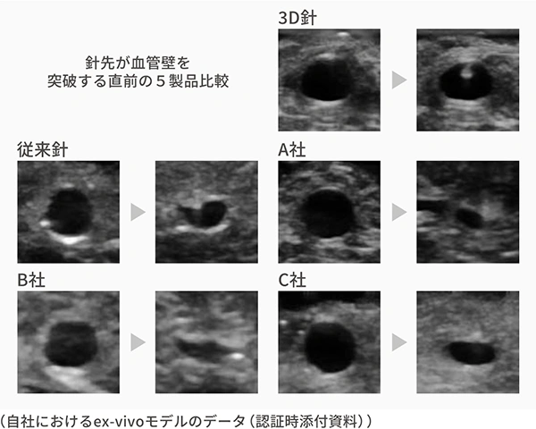 ＜穿刺時の血管変形が低減＞ 従来針・競合品の留置針に 比べて、血管の潰れ、逃げが 小さい結果が得られました。/＜穿刺時の血管変形が低減＞ 従来針・競合品の留置針に 比べて、血管の潰れ、逃げが小さい結果が得られました。 （自社におけるex-vivoモデルのデータ（認証時添付資料））